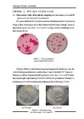 Khảo sát một số đặc điểm sinh học của giống Saccharomyces cerevisae F28