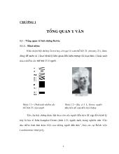 Tổng quan về hội chứng Down